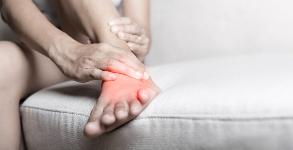 Sưng ở bàn chân, mắt cá chân hoặc bụng, thường do suy tim phải hoặc ứ trệ tuần hoàn kéo dài